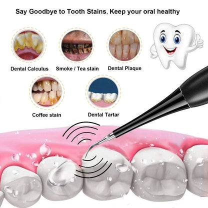 (👨‍⚕🦷Buy 2 Free Shipping)Electric tooth cleaning instrument -Teeth Cleaner